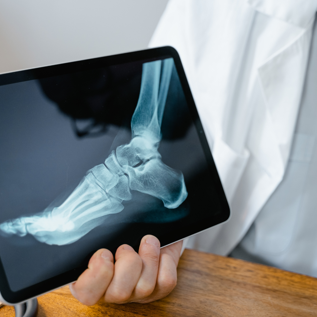 X-ray analysis for treatment at the No1 and Best Orthopaedic Physiotherapy in JP Nagar Bangalore.